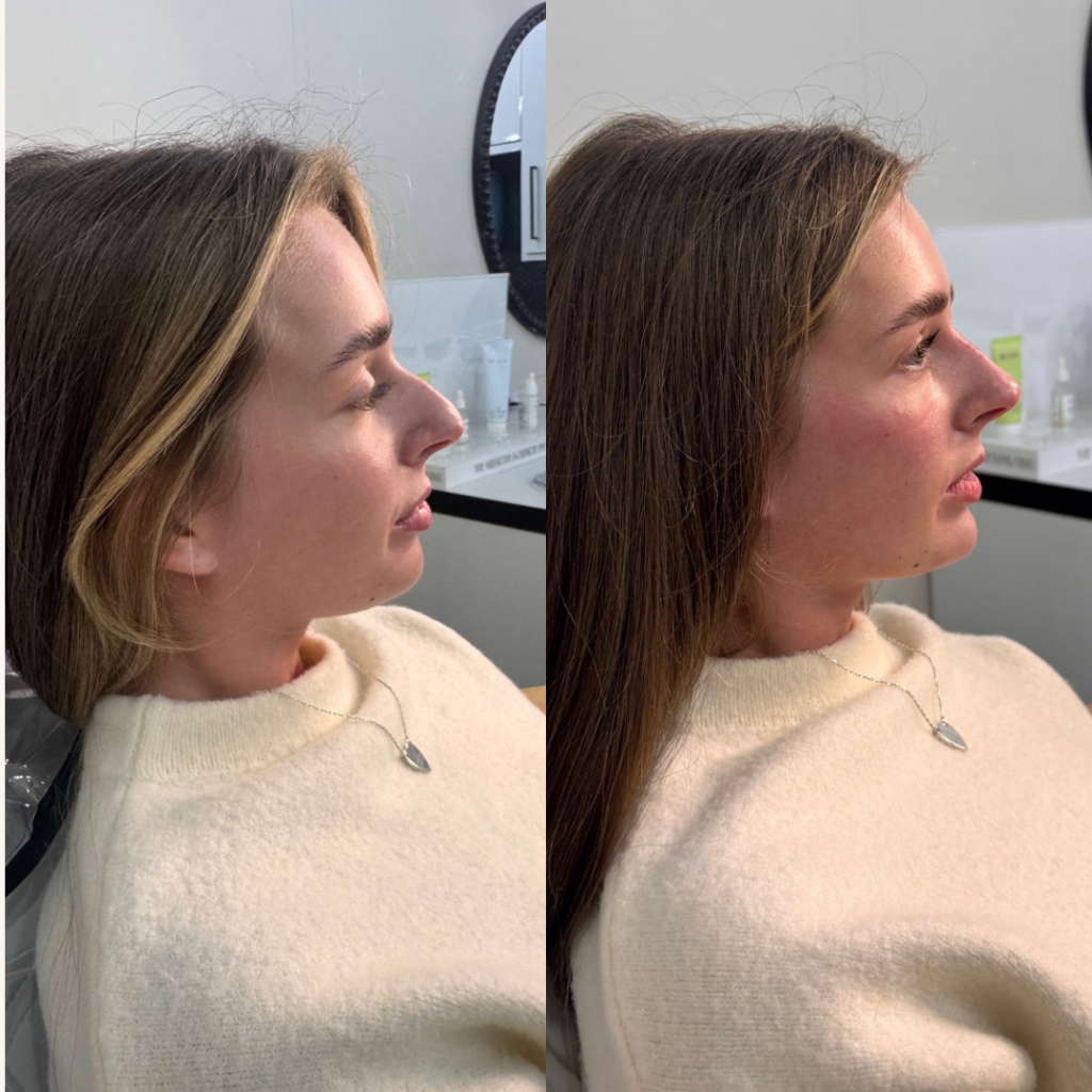 Beige Minimalist Skincare Before and After Instagram Post