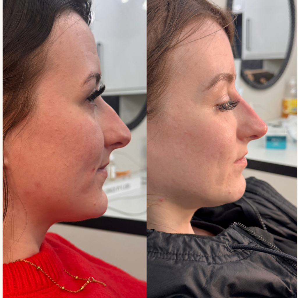 Beige Minimalist Skincare Before and After Instagram Post.png