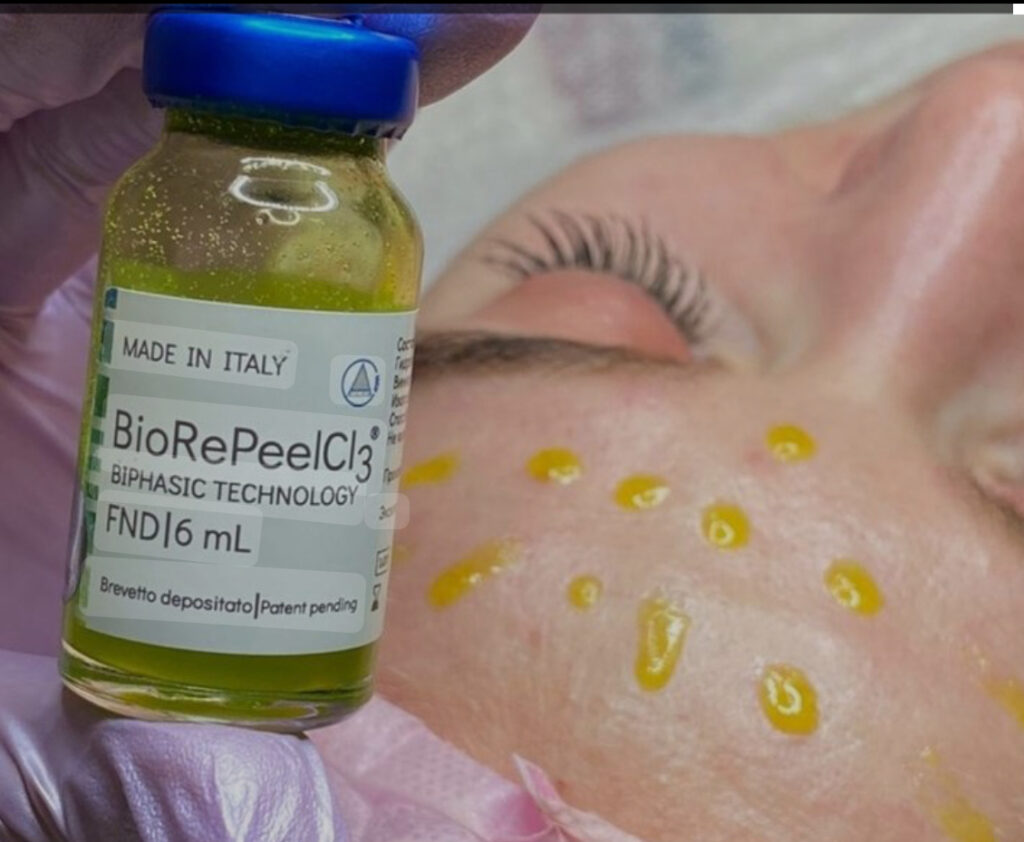 BioRePeel